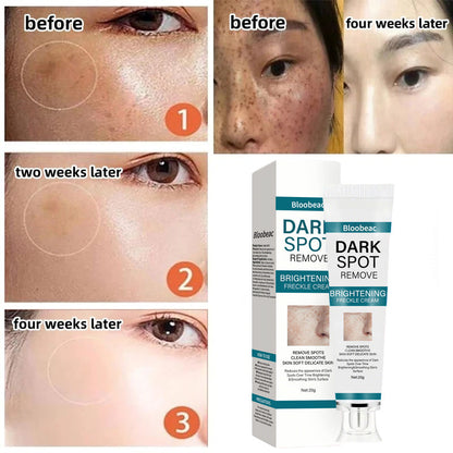 Say goodbye to hyperpigmentation - and hello to even, radiant skin