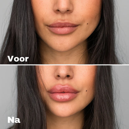 LushLip™ | Maximum Lip Volume