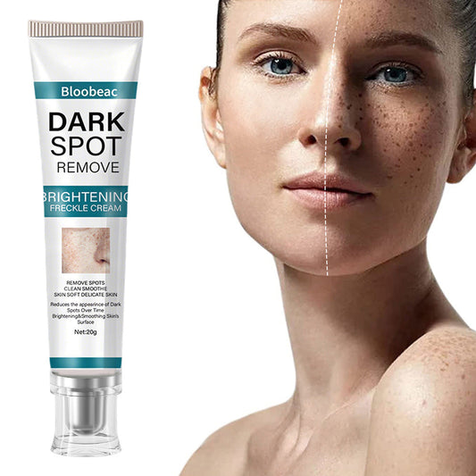 Say goodbye to hyperpigmentation - and hello to even, radiant skin