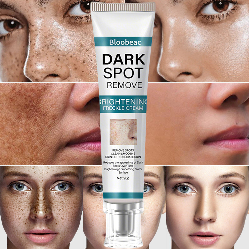 Say goodbye to hyperpigmentation - and hello to even, radiant skin