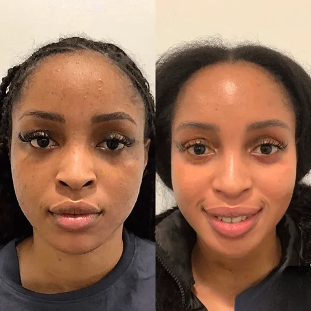 Collagen Night – Awaken with full, silky-soft skin