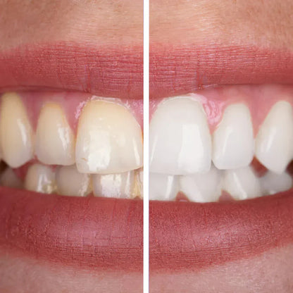 Bright™ PurpleWhite