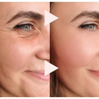 Instant Wrinkle Eraser - Wrinkles disappear in 10 seconds