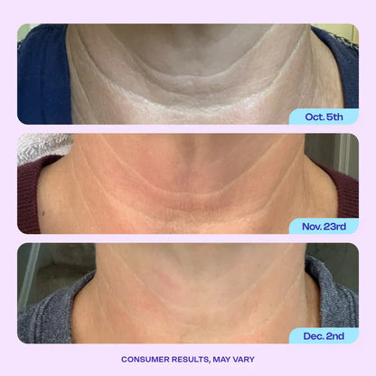 Stop hiding — restore the youthful power of your neck with GOPUCE
