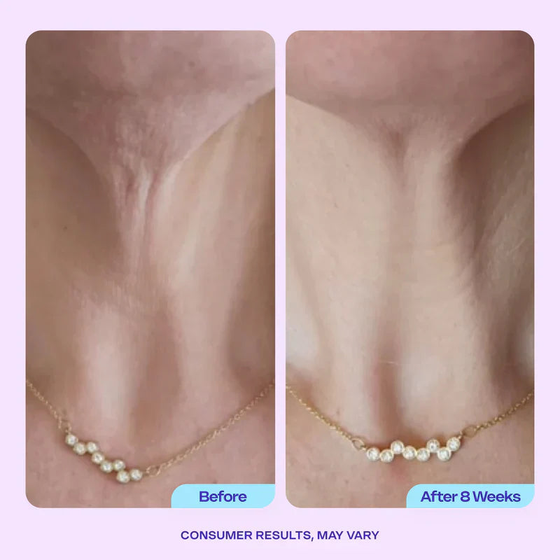 Stop hiding — restore the youthful power of your neck with GOPUCE