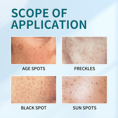 Say goodbye to hyperpigmentation - and hello to even, radiant skin