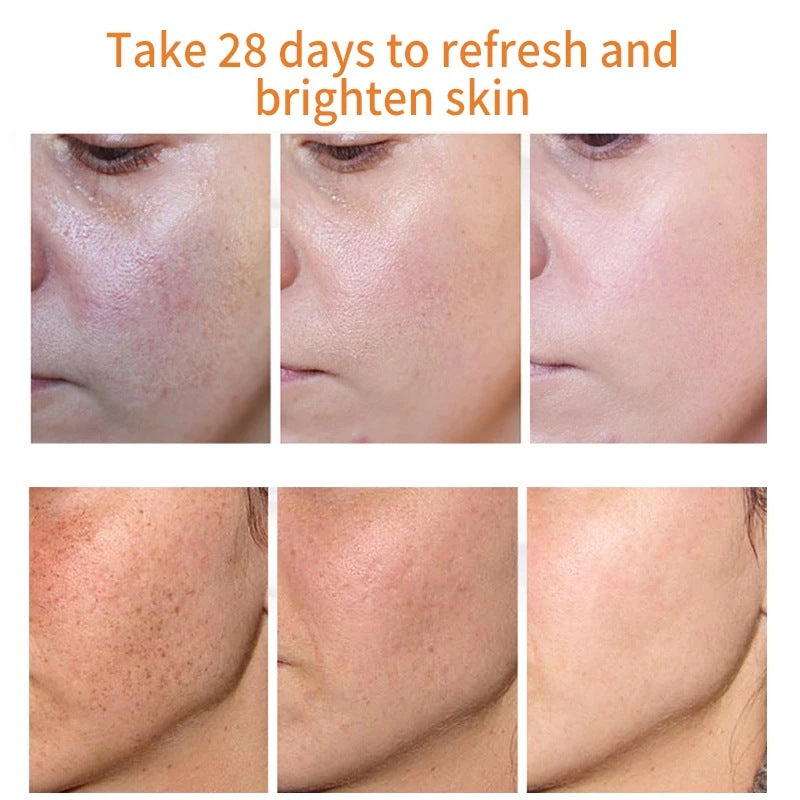 Say goodbye to hyperpigmentation - and hello to even, radiant skin