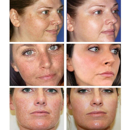 Say goodbye to hyperpigmentation - and hello to even, radiant skin