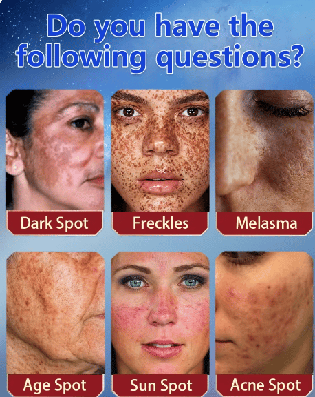 Say goodbye to hyperpigmentation - and hello to even, radiant skin